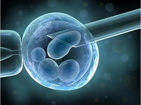 Application of High Speed Camera in Single Cell Separation Technology