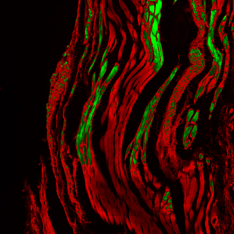 Application of sCMOS Scientific Cameras in Widefield Fluorescence Imaging