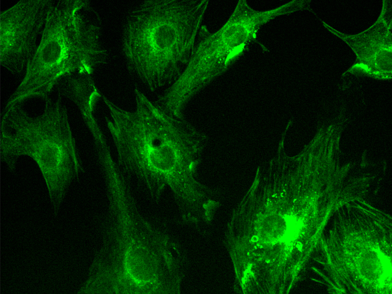 Application of sCMOS Scientific Cameras in Widefield Fluorescence Imaging