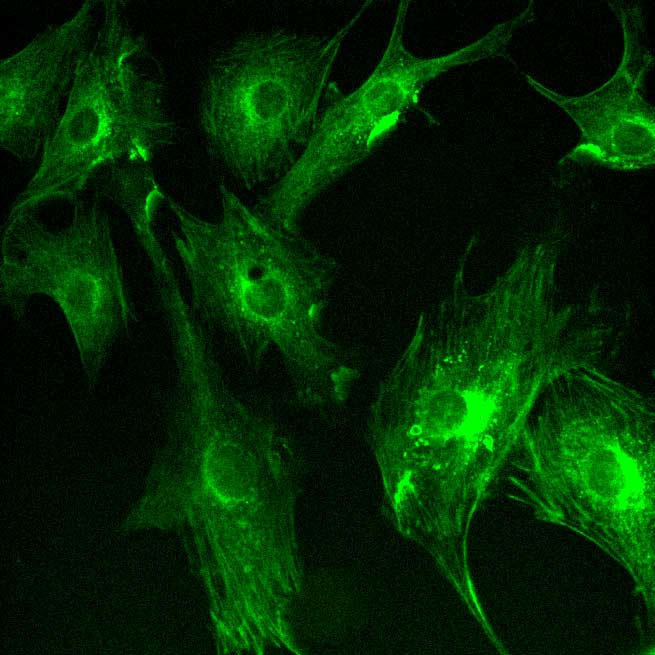application of scmos scientific cameras in widefield fluorescence imaging 1