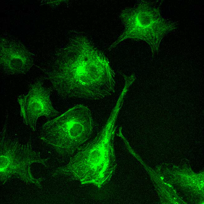 application of scmos scientific cameras in widefield fluorescence imaging 2
