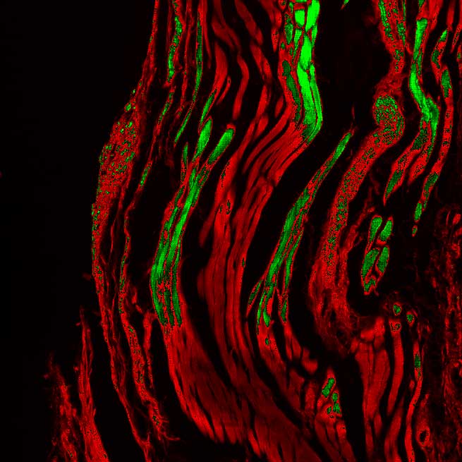application of scmos scientific cameras in widefield fluorescence imaging 3
