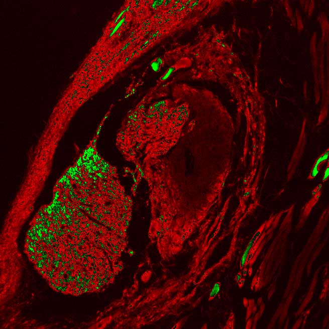 application of scmos scientific cameras in widefield fluorescence imaging 4