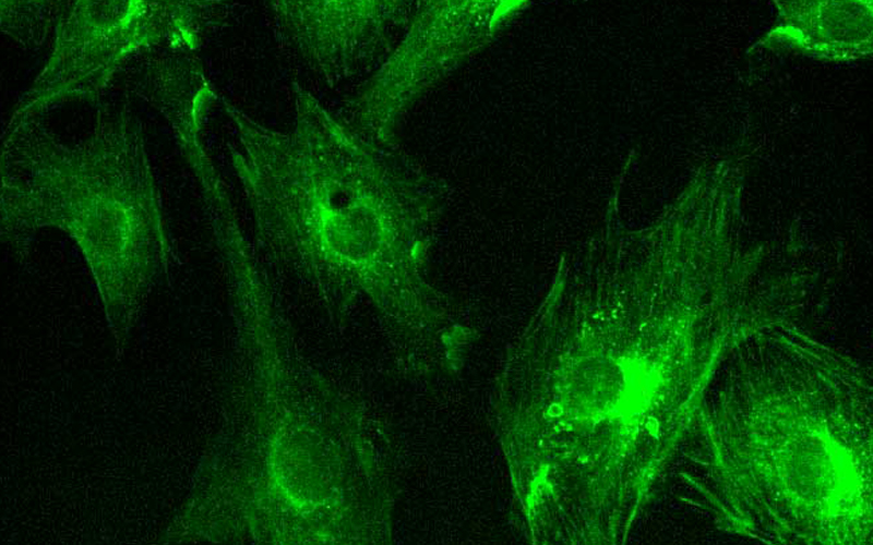 Application of sCMOS Scientific Cameras in Widefield Fluorescence Imaging