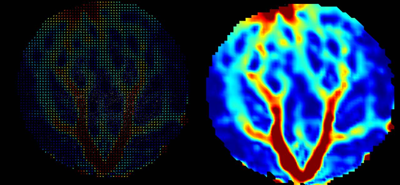 figure-velocity-vector-diagrams-and-velocity-cloud-maps-of-fluid-inside-the-electrolytic-cell-measured-using-revealer-high-frequency-2d2c-piv-system.jpg
